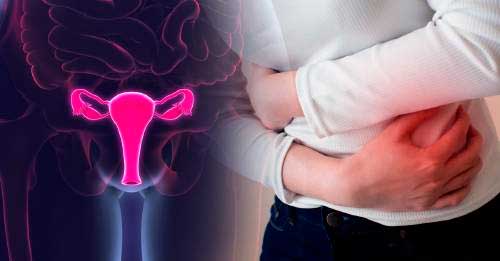 Sintomas de Quistes en los Ovarios