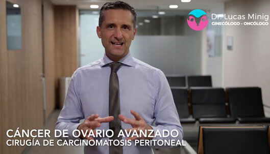 Tratamiento del Cáncer de Ovarios España
