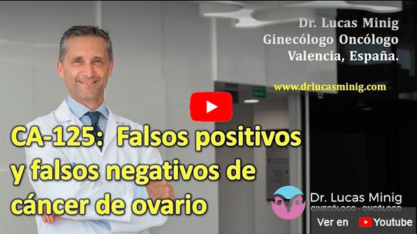 CA-125 Falsos Positivos y falsos negativos de cáncer de ovario.