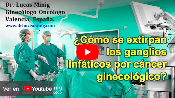 Cirugía Extirpación Ganglios linfaticos