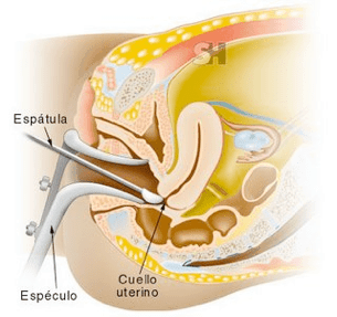 Citologia Cervical en España. Ginecología