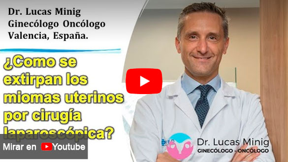 Como se extirpan los miomas uterinos por cirugía laparoscópica