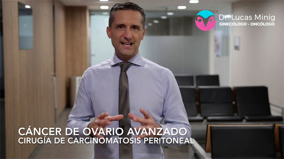 ¿Cómo se ve el cáncer de ovario dentro de la cavidad abdominal? Dr. Lucas Minig, Valencia, España