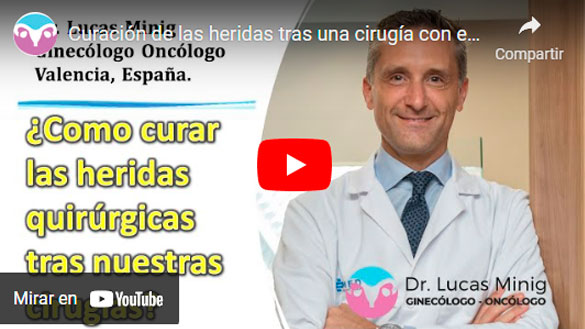Cómo hay que cuidar las heridas quirúrgicas tras Cirugía Ginecologica Oncologica en España